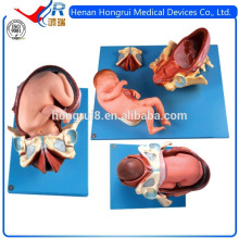 ISO Delivery Process of Term Fetus, Birthing Simulators